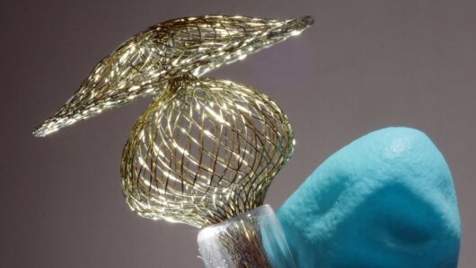 Aus einer superelastischen Nickel-Titan-Legierung besteht dieses medizinische Implantat (Okkluder), das zur Behandlung von Defekten der Herzscheidewand eingesetzt wird.